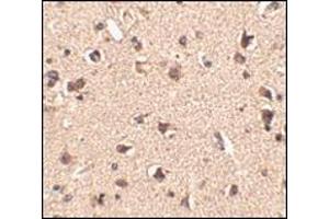 Immunohistochemistry of Slitrk6 in human brain tissue with this product at 2. (SLITRK6 anticorps  (Center))