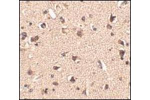 Immunohistochemistry of Slitrk6 in human brain tissue with this product at 2.
