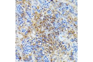 Immunohistochemistry of paraffin-embedded rat spleen using COX15 antibody (ABIN7266634) at dilution of 1:100 (40x lens).
