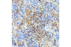 Immunohistochemistry of paraffin-embedded rat spleen using COX15 antibody (ABIN7266634) at dilution of 1:100 (40x lens). (COX15 anticorps  (AA 150-250))