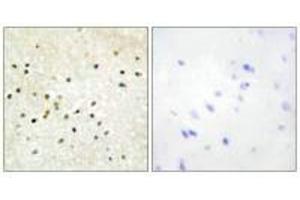 Immunohistochemistry analysis of paraffin-embedded human brain tissue using TF2H1 antibody.