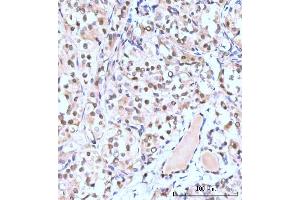 IHC analysis of Nesprin3/SYNE3 using anti-Nesprin3/SYNE3 antibody (ABIN7601328). (Nesprin3 anticorps  (AA 322-495))