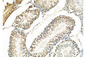 ABIN6261307 and ABIN6277247 at 1/100 staining Rat testis tissue by IHC-P. (DKK3 anticorps)