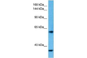 Host:  Rabbit  Target Name:  KIDINS220  Sample Tissue:  Human HT1080 Whole Cell lysates  Antibody Dilution:  1ug/ml (KIDINS220 anticorps  (Middle Region))