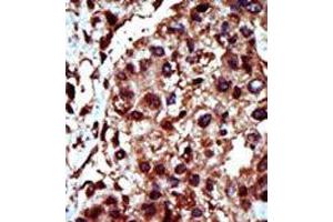 Image no. 1 for anti-Diacylglycerol Kinase, iota (DGKI) (C-Term) antibody (ABIN360602) (DGKI anticorps  (C-Term))