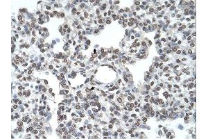 Immunohistochemistry (IHC) image for anti-Transmembrane Protease, serine 11D (TMPRSS11D) (Middle Region) antibody (ABIN2782622) (TMPRSS11D anticorps  (Middle Region))