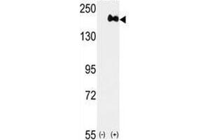 Western blot analysis of anti-HER2 antibody and 293 cell lysate (2 ug/lane) either nontransfected (Lane 1) or transiently transfected with the ERBB2 gene (2).