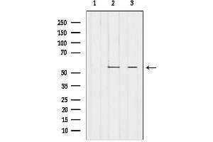 Western blot analysis of lysates from various samples, using PTGIS Antibody.
