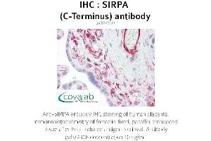 Image no. 1 for anti-Signal-Regulatory Protein alpha (SIRPA) antibody (ABIN1739273) (SIRPA anticorps)