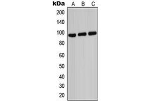 Western blot analysis of ABCB7 expression in HeLa (A), Raw264.
