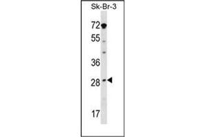 Western blot analysis in SK-BR-3 cell line lysates (35ug/lane) using STAR / STARD1 Antibody (Center) Cat. (STAR anticorps  (Middle Region))