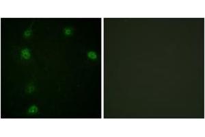 Immunofluorescence analysis of HeLa cells, using Cyclin E1 (Phospho-Thr77) Antibody. (Cyclin E1 anticorps  (pThr77))