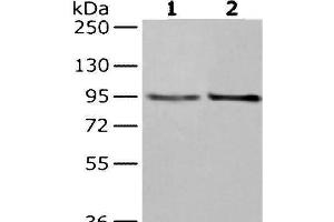 Western Blot analysis of Hela and K562 cells using NUP98 Polyclonal Antibody at dilution of 1/350 (NUP98 anticorps)