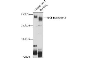 Western blot analysis of extracts of various cell lines, using VEGF Receptor 2 antibody (ABIN6132247, ABIN6142816, ABIN6142819 and ABIN6215074) at 1:500 dilution. (VEGFR2/CD309 anticorps  (AA 20-200))