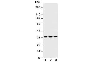 Western blot testing of SDHB antibody and Lane 1:  rat testis