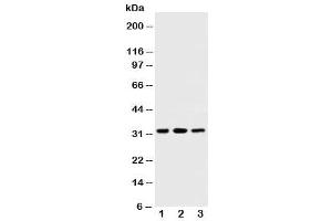 Western blot testing of SDHB antibody and Lane 1:  rat testis (SDHB anticorps  (AA 42-59))