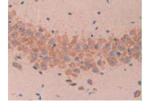 IHC-P analysis of Mouse Brain Tissue, with DAB staining. (MUC1 anticorps  (AA 410-525))