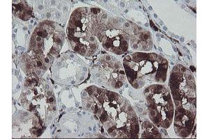 Image no. 1 for anti-Coagulation Factor XIII, A1 Polypeptide (F13A1) antibody (ABIN1498150)