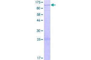Image no. 1 for Patatin-Like phospholipase Domain Containing 8 (PNPLA8) (AA 1-782) protein (GST tag) (ABIN1315593)
