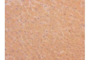 Figure. (TPSAB1 anticorps  (AA 161-262))