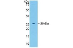 Detection of Recombinant GSTa4, Mouse using Polyclonal Antibody to Glutathione S Transferase A4 (GSTA4) (GSTA4 anticorps  (AA 1-222))