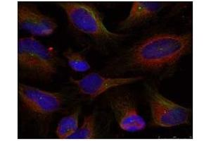 Image no. 2 for anti-Nuclear Factor of kappa Light Polypeptide Gene Enhancer in B-Cells 2 (NFKB2) (Ser871) antibody (ABIN197572)
