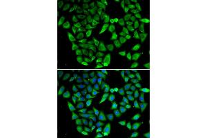 Immunofluorescence analysis of HeLa cell using ASIP antibody. (ASIP anticorps)