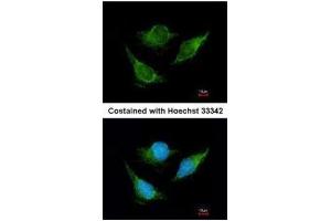 ICC/IF Image Immunofluorescence analysis of methanol-fixed HeLa, using IVD, antibody at 1:200 dilution.