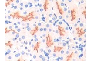 Detection of APOD in Mouse Kidney Tissue using Polyclonal Antibody to Apolipoprotein D (APOD)