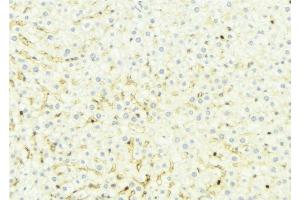 ABIN6274916 at 1/100 staining Mouse liver tissue by IHC-P.