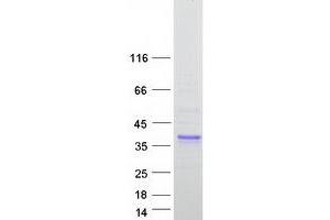 Validation with Western Blot