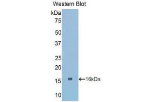 Western Blotting (WB) image for anti-Connective Tissue Growth Factor (CTGF) (AA 80-200) antibody (ABIN1858525) (CTGF anticorps  (AA 80-200))