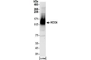 anti-Solute Carrier Family 12 (Potassium-Chloride Transporter) Member 7 (SLC12A7) (AA 1-50) antibody