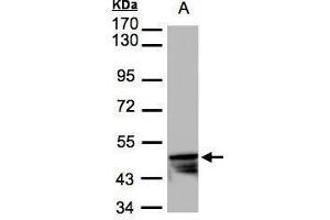 WB Image Sample(30 μg of whole cell lysate) A:HeLa S3, 7. (KRT14 anticorps)