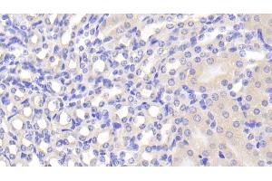 Detection of FUCa1 in Mouse Kidney Tissue using Polyclonal Antibody to Fucosidase Alpha L1, Tissue (FUCa1)