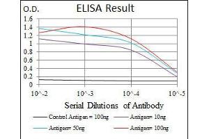 anti-Eukaryotic Translation Initiation Factor 4B (EIF4B) antibody