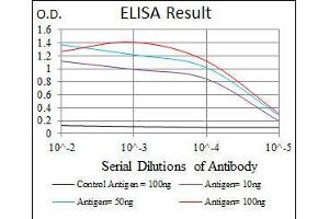 Black line: Control Antigen (100 ng), Purple line: Antigen(10 ng), Blue line: Antigen (50 ng), Red line: Antigen (100 ng), (EIF4B anticorps)