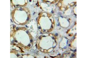 Used in DAB staining on fromalin fixed paraffin-embedded pancreas tissue (Tetraspanin 3 anticorps  (AA 107-213))