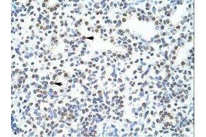 Image no. 1 for anti-Pogo Transposable Element with ZNF Domain (POGZ) (N-Term) antibody (ABIN203011)