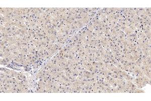 Detection of SHH in Human Liver Tissue using Monoclonal Antibody to Hedgehog Homolog, Sonic (SHH)