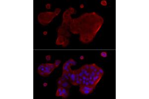 Immunoprecipitation analysis of 200 μg extracts of THP-1 cells, using 3 μg Caspase-1 antibody (ABIN3021170, ABIN3021171, ABIN3021172 and ABIN6214049).