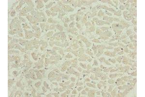 Immunohistochemistry of paraffin-embedded human heart tissue using ABIN7146448 at dilution of 1:100 (CAMK2D anticorps  (AA 1-260))