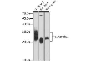 Western blot analysis of extracts of various cell lines, using CD90/Thy1 antibody (ABIN6129735, ABIN6148554, ABIN6148555 and ABIN7101405) at 1:1000 dilution. (CD90 anticorps)
