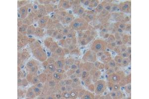 Used in DAB staining on fromalin fixed paraffin- embedded Kidney tissue