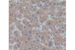 Used in DAB staining on fromalin fixed paraffin- embedded Kidney tissue (UQCRB anticorps  (AA 2-111))