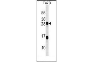 Western blot analysis of KDELR2 Antibody (C-term) in T47D cell line lysates (35ug/lane). (KDELR2 anticorps  (C-Term))