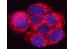 IF analysis of HSD17B7 using anti-HSD17B7 antibody (ABIN7600174). (HSD17B7 anticorps  (AA 16-336))