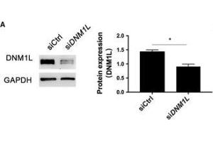 DNM1L deficiency alters mitochondria morphology and mitochondrial membrane potential in FLSs.