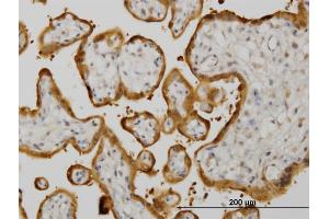 Immunoperoxidase of monoclonal antibody to HSPB8 on formalin-fixed paraffin-embedded human placenta.