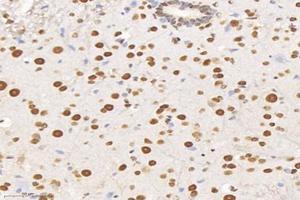 Immunohistochemistry analysis of paraffin-embedded mouse spinal cord using,SET (ABIN7075583) at dilution of 1: 10000